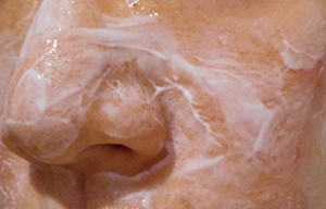 洗顔後、麻酔クリームを肌が隠れるまで分厚く塗布